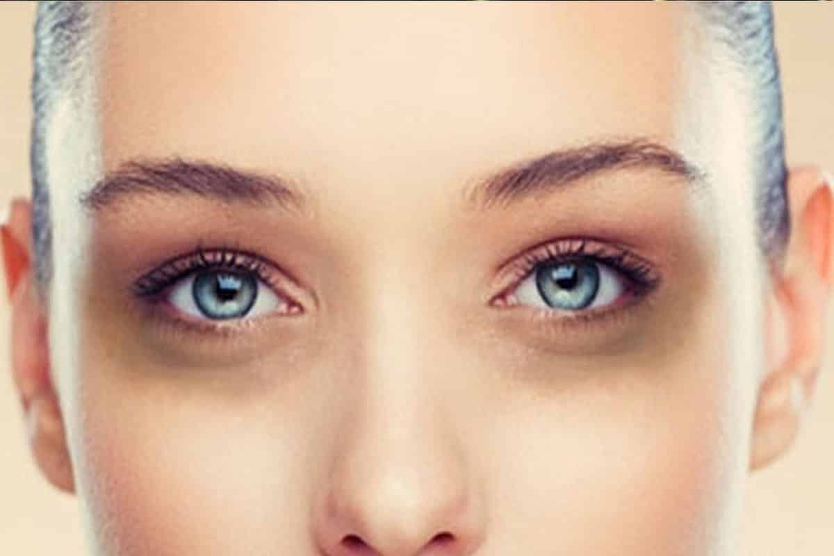 Bỏ túi những tips cách trị quầng thâm mắt tại nhà hiệu quả